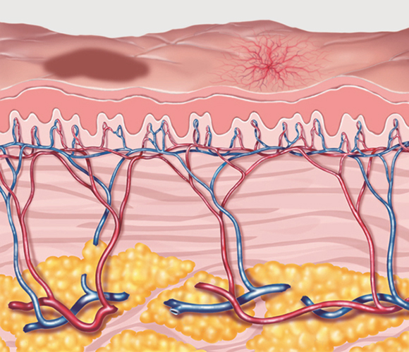 シミ・ソバカスのできた肌